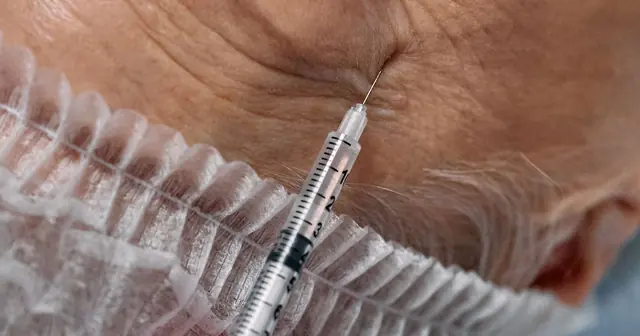 Botox Aftercare: What To Do After Treatment