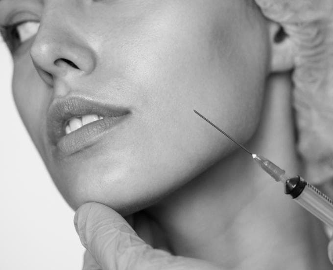 Dermal Fillers